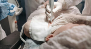 Britanka (87) će za tretman podmlađivanja dati 343 hiljade evra